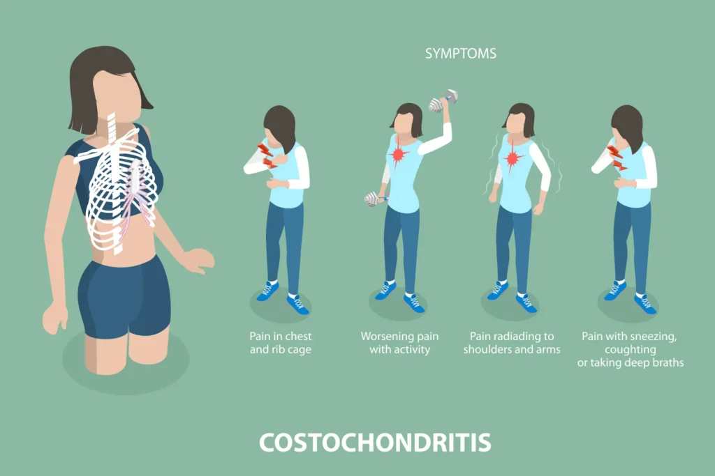 Illustration of costochondritis symptoms, including chest pain, worsening pain with activity, pain radiating to shoulders and arms, and discomfort when sneezing or coughing.