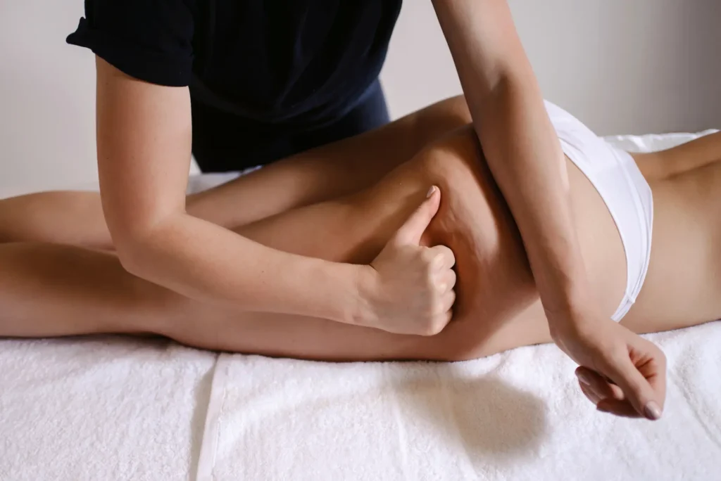 Therapist gripping and kneading the skin and connective tissue on the thigh to release tight fascia and target cellulite beneath the surface.